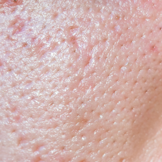 What the heck are 'pores'?